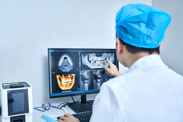 Best Emergency Wisdom Teeth Removal in Oneonta, AL